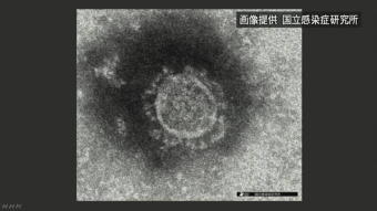 5491-340新型ウイルス